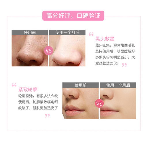 男士專用洗臉儀電動(dòng)硅膠潔面刷充電去黑頭潔面神器深層毛孔清潔器